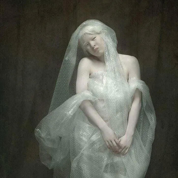 Abandoned As A Baby Due To Albinism, Xueli Grew Up To Become A Vogue Model (30 Pics)