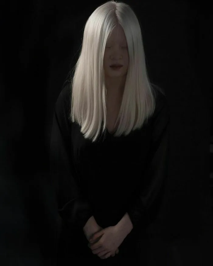 Abandoned As A Baby Due To Albinism, Xueli Grew Up To Become A Vogue Model (30 Pics)