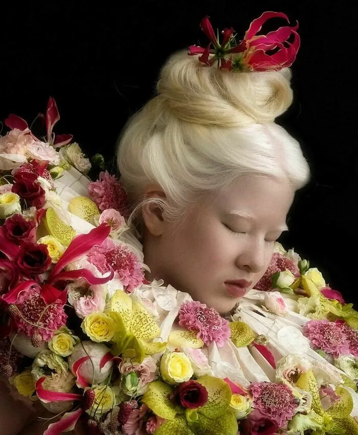 Abandoned As A Baby Due To Albinism, Xueli Grew Up To Become A Vogue Model (30 Pics)