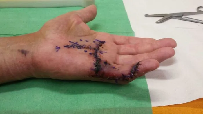 Hand Job.