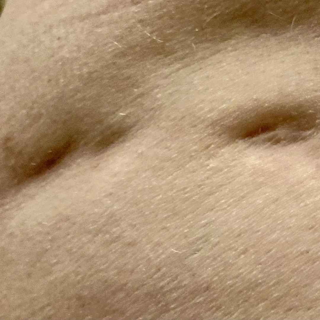 I Interview People About Their Scars