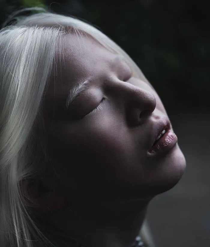 Abandoned As A Baby Due To Albinism, Xueli Grew Up To Become A Vogue Model (30 Pics)