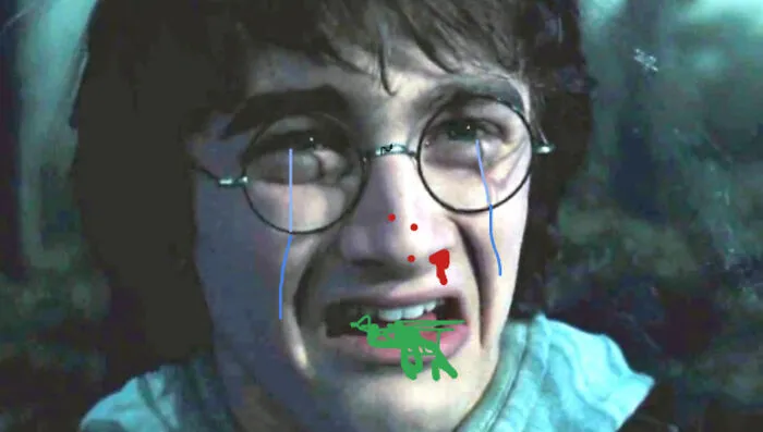 Poor Harry
