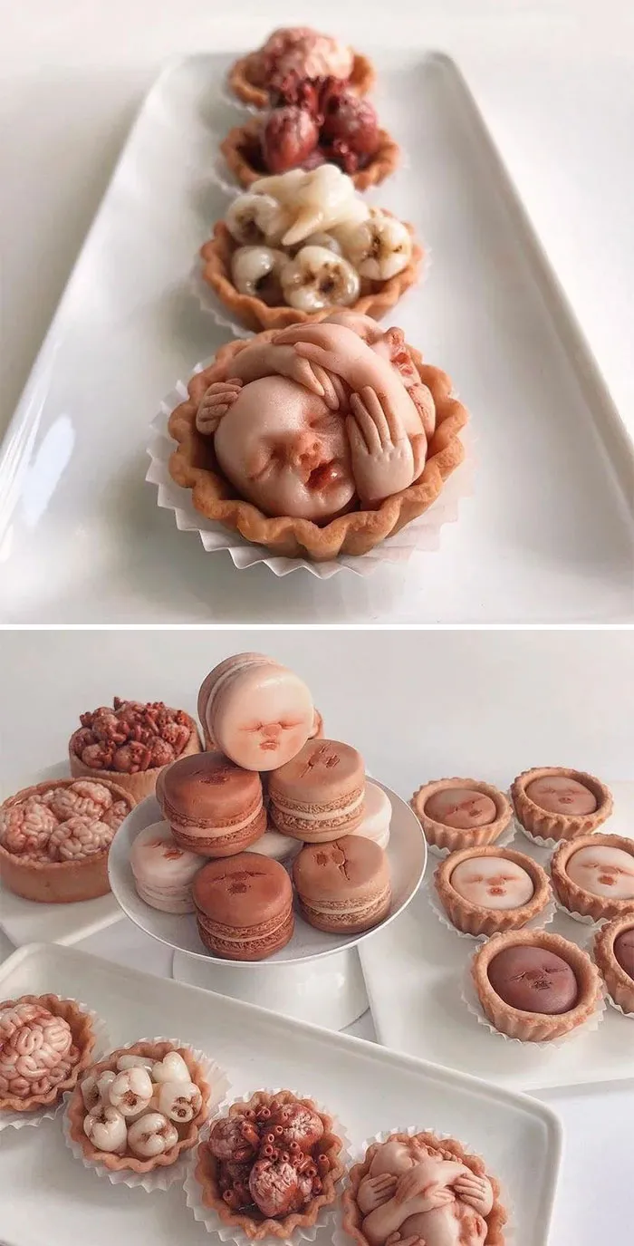 Anatomical Tartlets