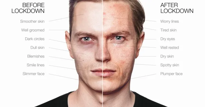 We Show The Impact Lockdown Has Had On Our Faces