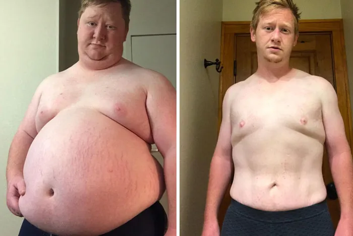 Lost 200 Pounds In A Year. 360 Lbs vs. 160 Lbs