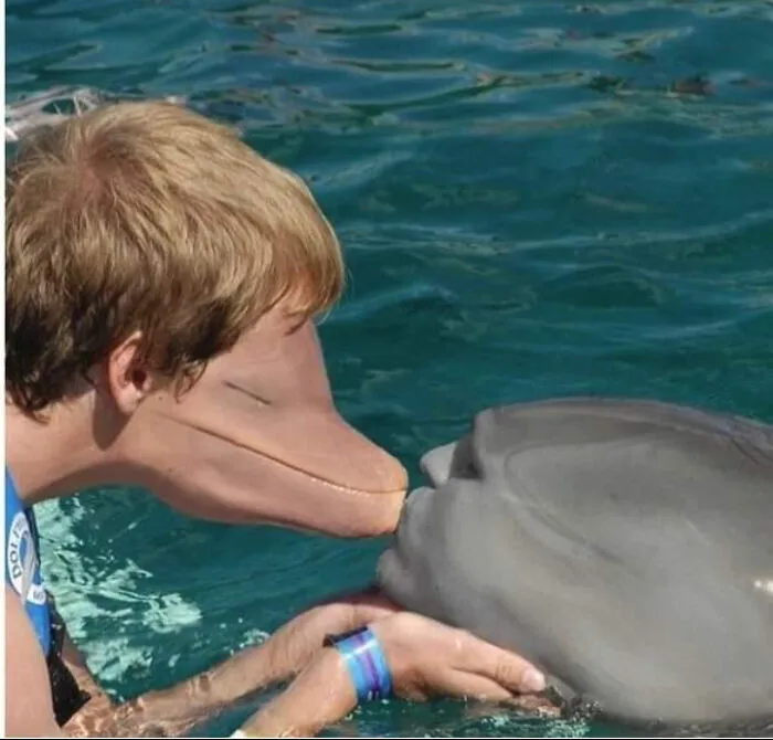 Dolphin Boy