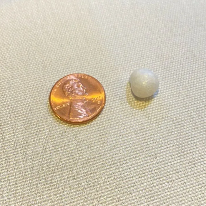 Ordered Fried Oysters From A Takeout Restaurant And Found A Pearl In One