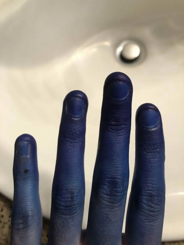 Accidentalmente me puse los guantes al revés. Mi estupidez no conoce límites