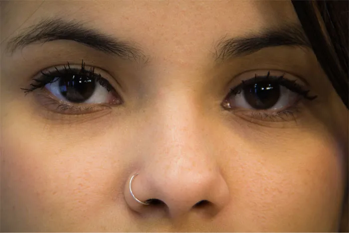 Glabella