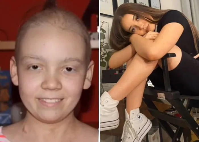 "How Hard Did Puberty Hit You": 30 People Who Took Part In This New TikTok Challenge And Shared Photos