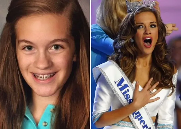 "How Hard Did Puberty Hit You": 30 People Who Took Part In This New TikTok Challenge And Shared Photos