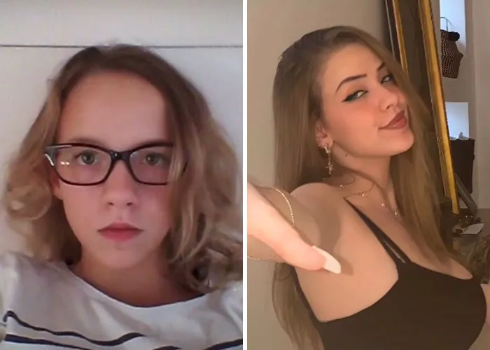 "How Hard Did Puberty Hit You": 30 People Who Took Part In This New TikTok Challenge And Shared Photos