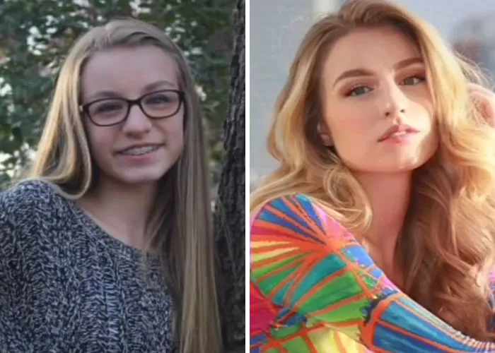 "How Hard Did Puberty Hit You": 30 People Who Took Part In This New TikTok Challenge And Shared Photos