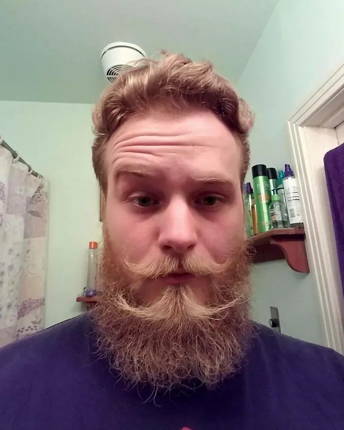 30 Times Men Decided To Try Out The Double Mustache Beard Trend And Got Ridiculous Results