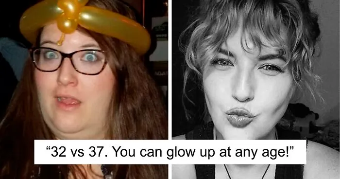 30 “Ugly Ducklings” Share Their Incredible Transformations Into Beautiful Swans (New Pics)