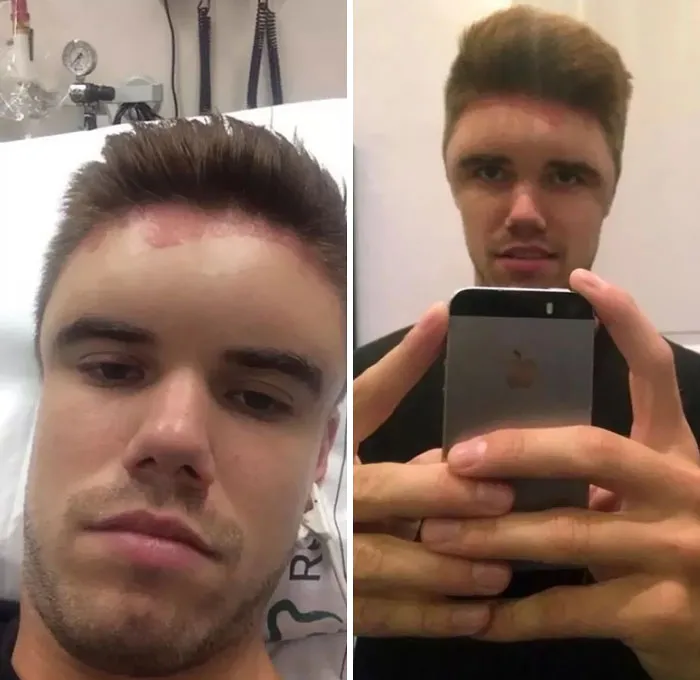 Allergic To Hair Dye