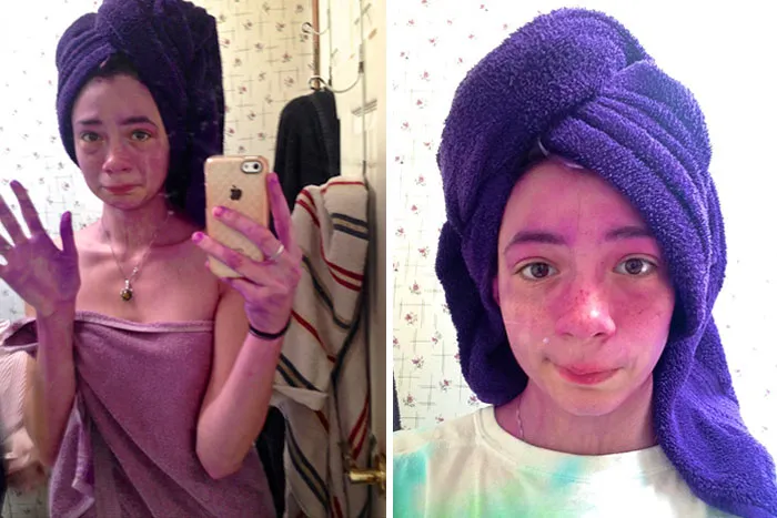 Purple Dye Disaster. I Was A Walking, Wide-Eyed Eggplant
