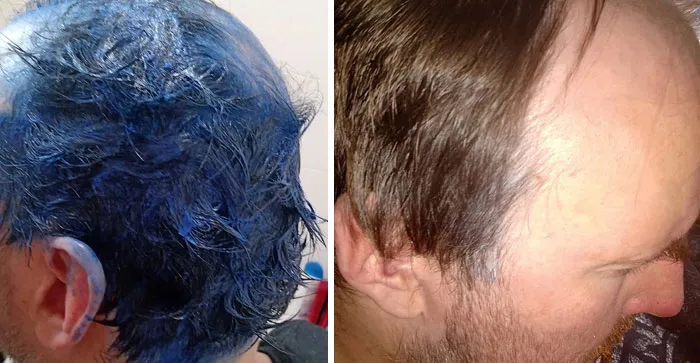 Durante… y después. Síp, el cabello de Neil no se tiñe