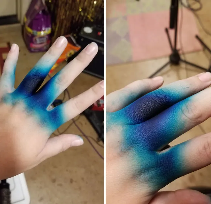 I Didn't Notice That My Glove Broke While Dyeing My Friend's Hair And Now My Hands Are Stained