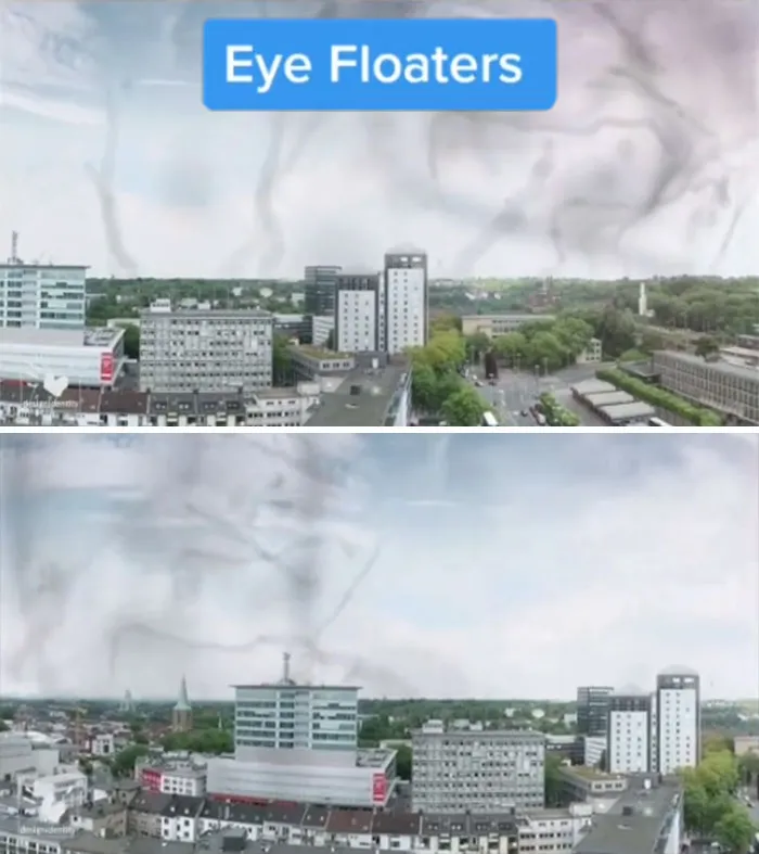Medical Student Shows How People With Certain Medical Conditions See (19 Pics)