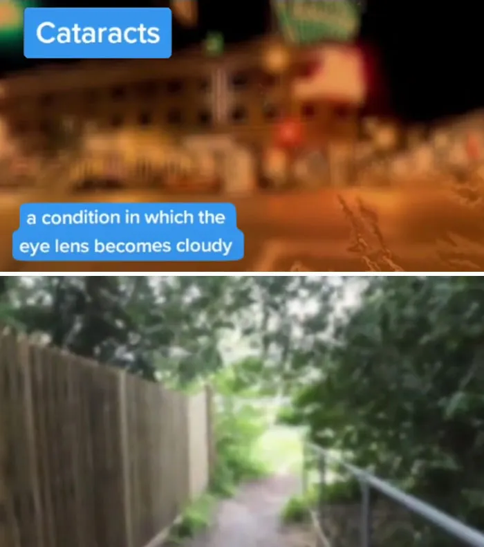 Medical Student Shows How People With Certain Medical Conditions See (19 Pics)