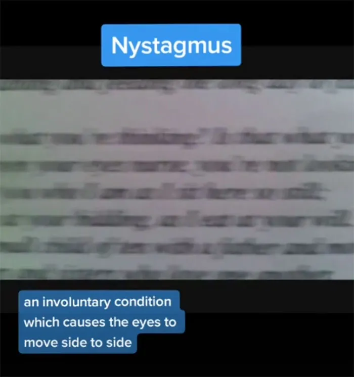 Medical Student Shows How People With Certain Medical Conditions See (19 Pics)