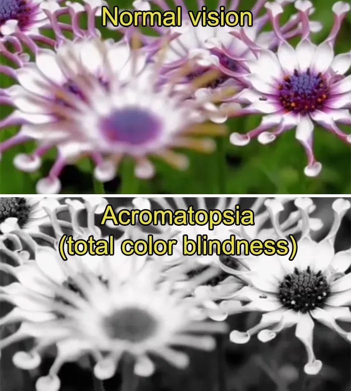 Medical Student Shows How People With Certain Medical Conditions See (19 Pics)