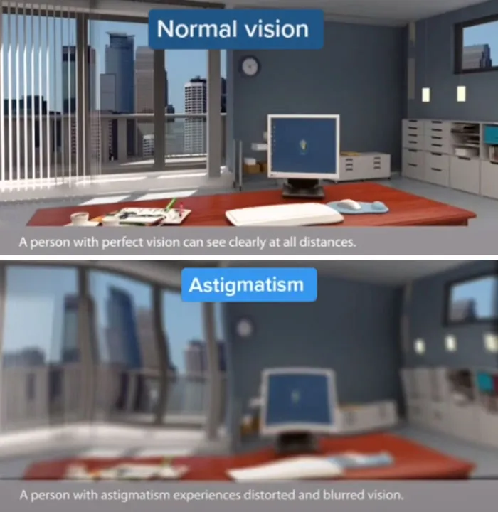 Medical Student Shows How People With Certain Medical Conditions See (19 Pics)
