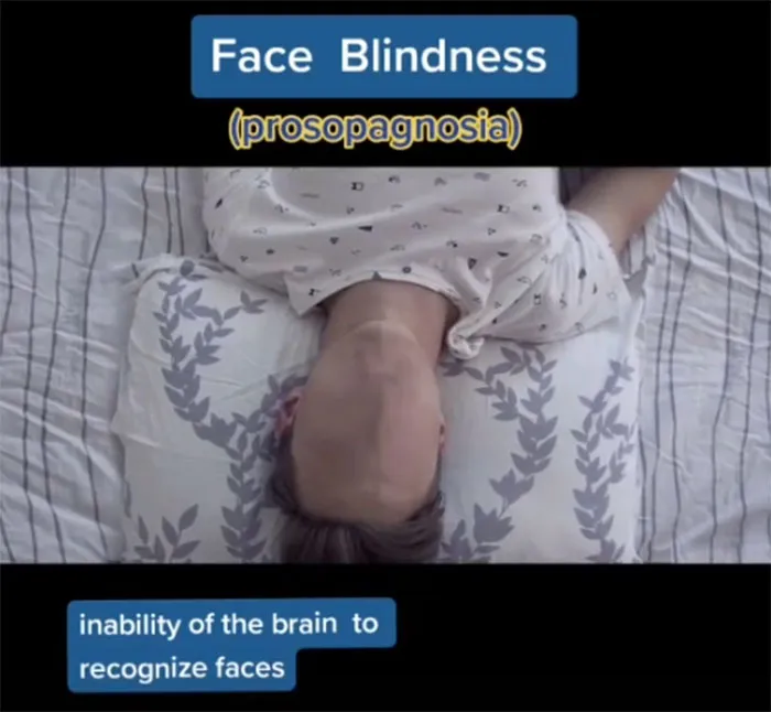 Medical Student Shows How People With Certain Medical Conditions See (19 Pics)