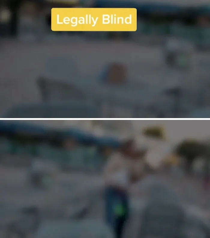 Medical Student Shows How People With Certain Medical Conditions See (19 Pics)