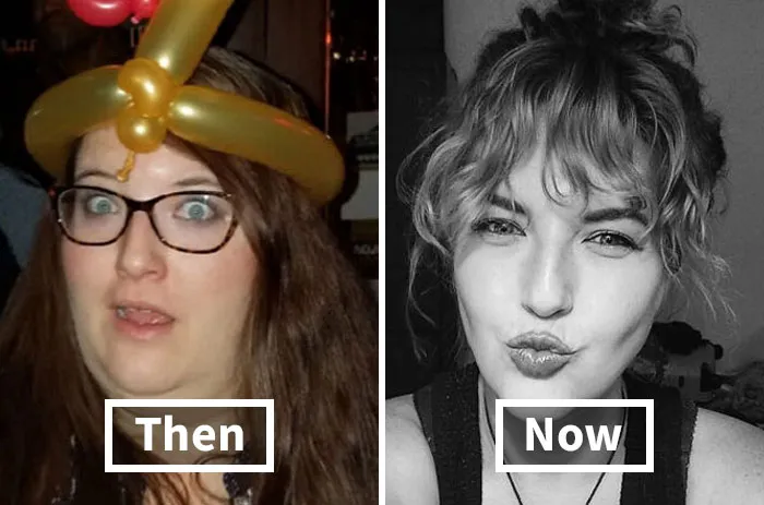 30 “Ugly Ducklings” Share Their Incredible Transformations Into Beautiful Swans (New Pics)
