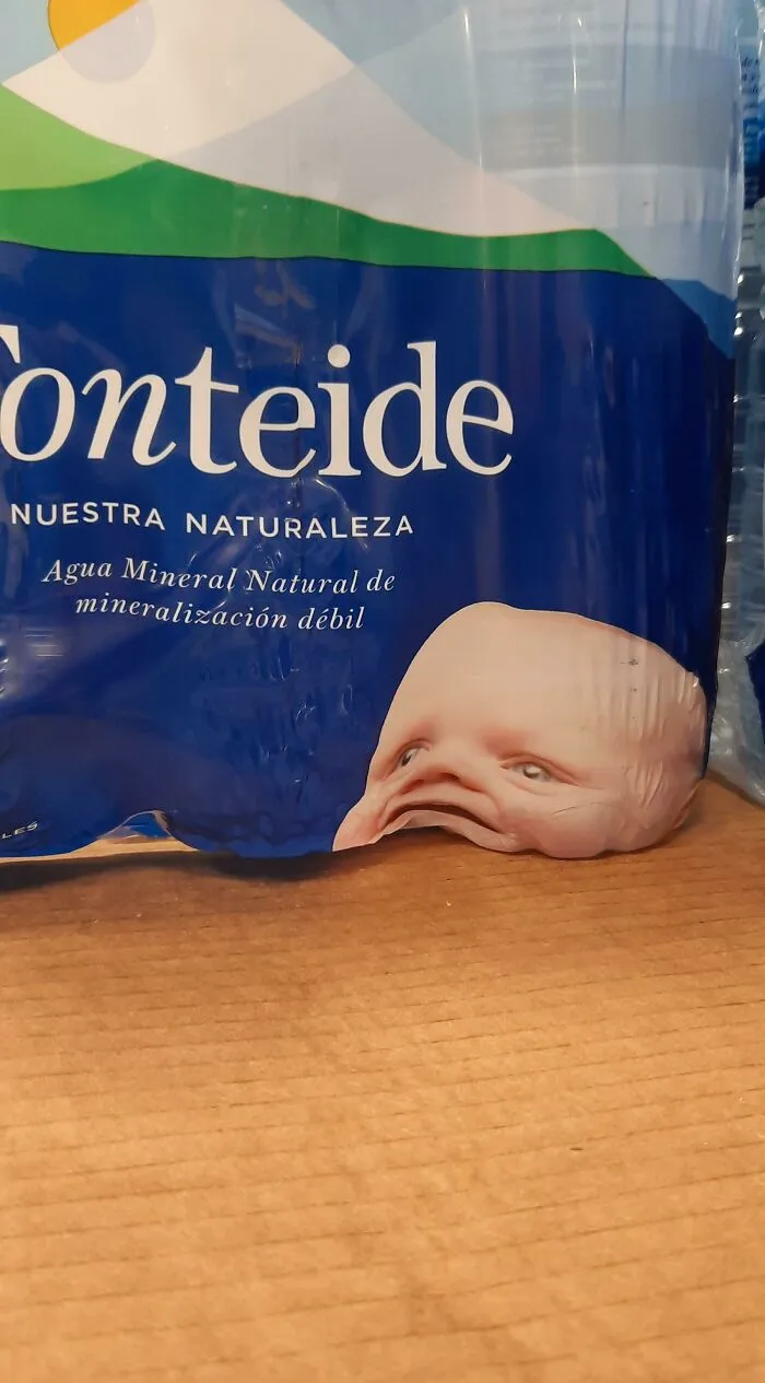 La colocación de la cabeza de este bebé no fue bien pensada