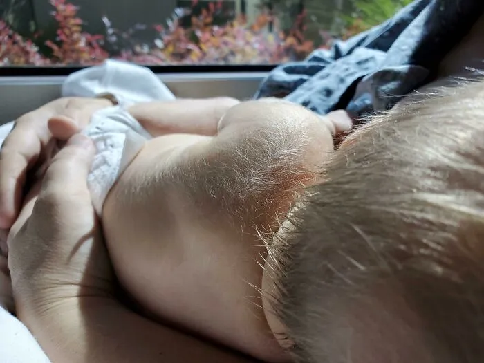 My Newborn Son Covered Head To Toe In White "Fur"
