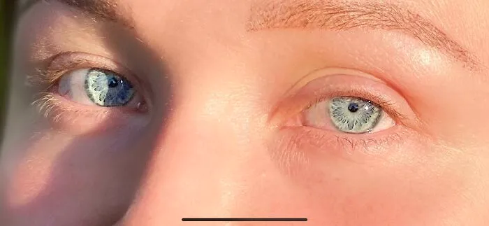El "patrón" en los ojos de mi esposa