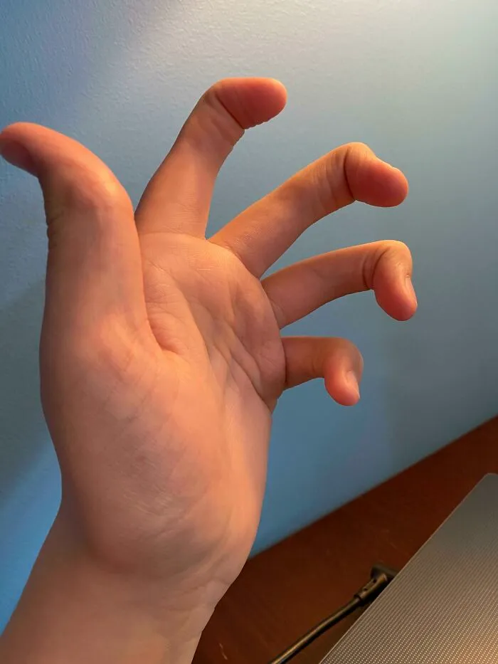 A mis dedos les falta una articulación