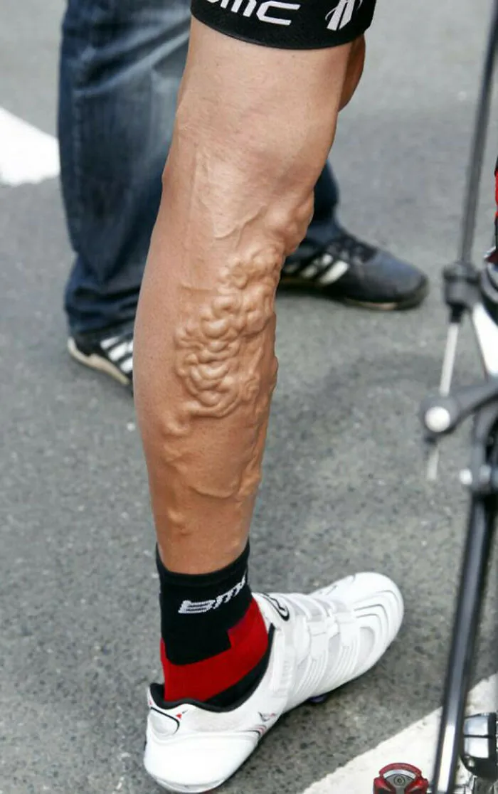 Las piernas de George Hincapie tras la carrera del Tour de Francia