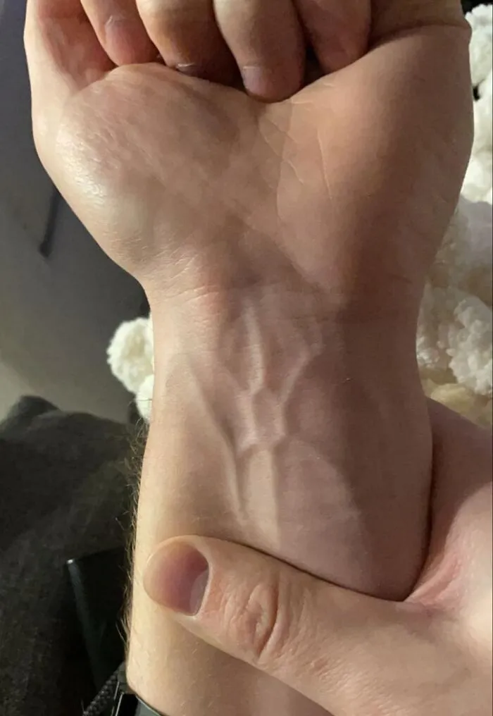 This Hexagon Vein Structure On My Wrist