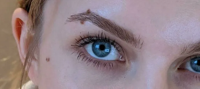I Have A Pair Of Moles, That Look Like An Eyebrow Piercing