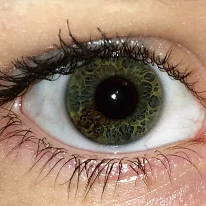 Pequeña heterocromía en mi ojo y un patrón interesante