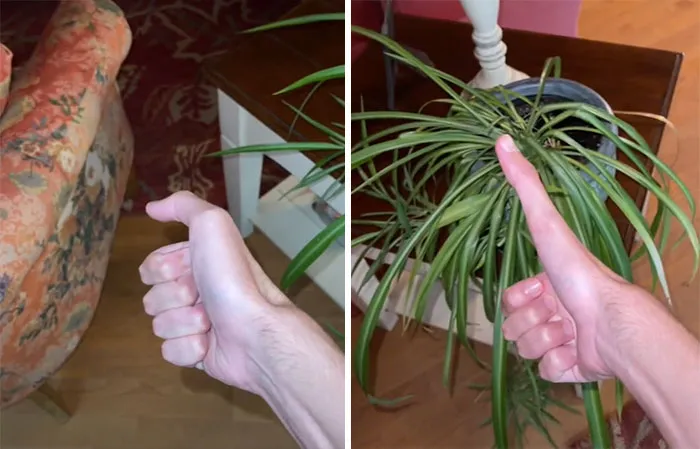 This Guy's Super-Long Thumb