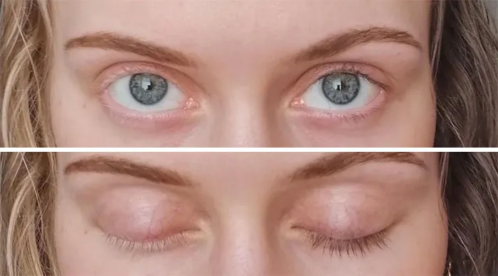 My Hair And Eyelashes Are Naturally Split Into Blonde And Brunette