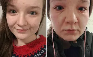 50 Photos Of Unique People's Features Because Of Their Rare Genetics (New Pics)
