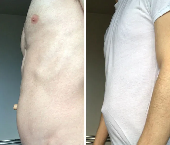 I Was Cursed With A Belly Button That Sticks Out Through My Shirts