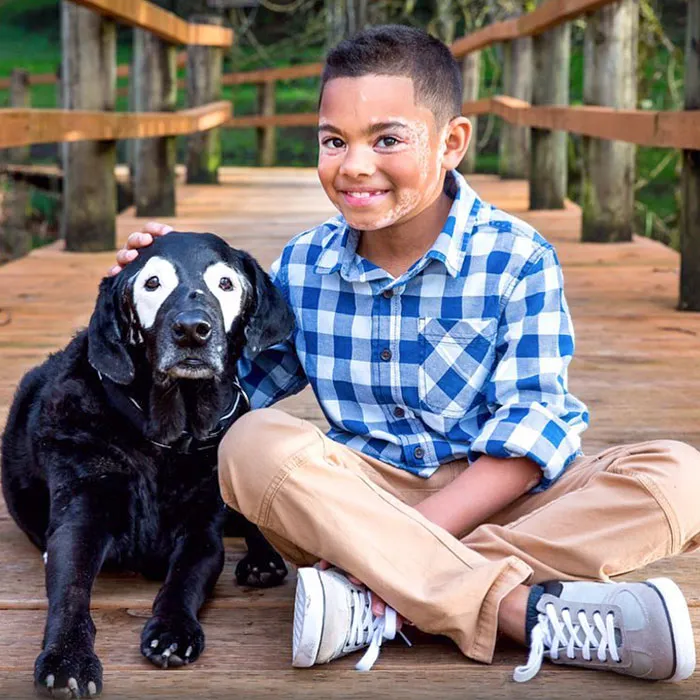 Carter Blanchard de 8 años y su perro Rowdy sufren ambos de un trastorno llamado vitiligo