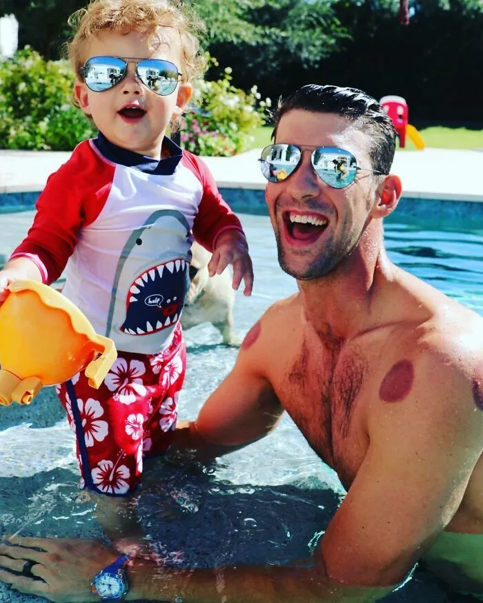 Michael Phelps After Cupping Therapy