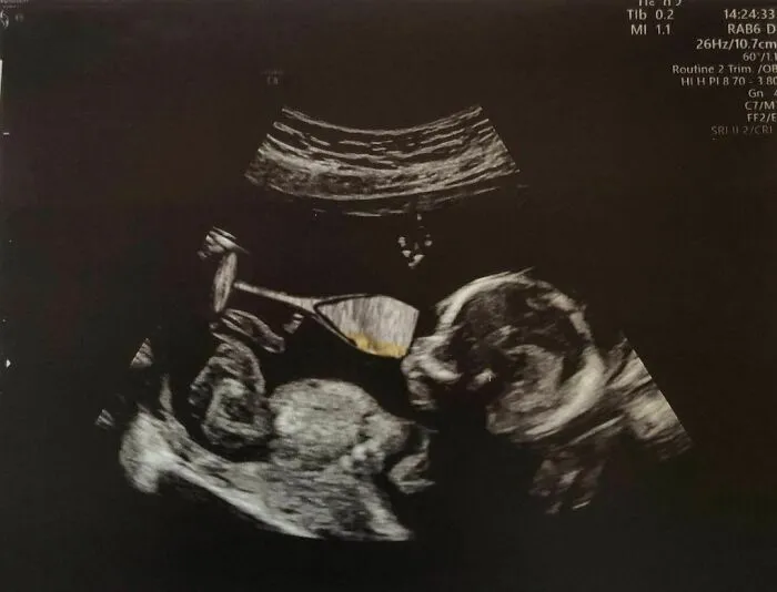 ¡¡Feliz Año Nuevo!! El 2020 fue un año extraño con tantas incertidumbres. Pero para nosotros 2021 comenzará con una hermana para Alix. ¡Así que espera un montón de nuevas aventuras con papá en 2021!