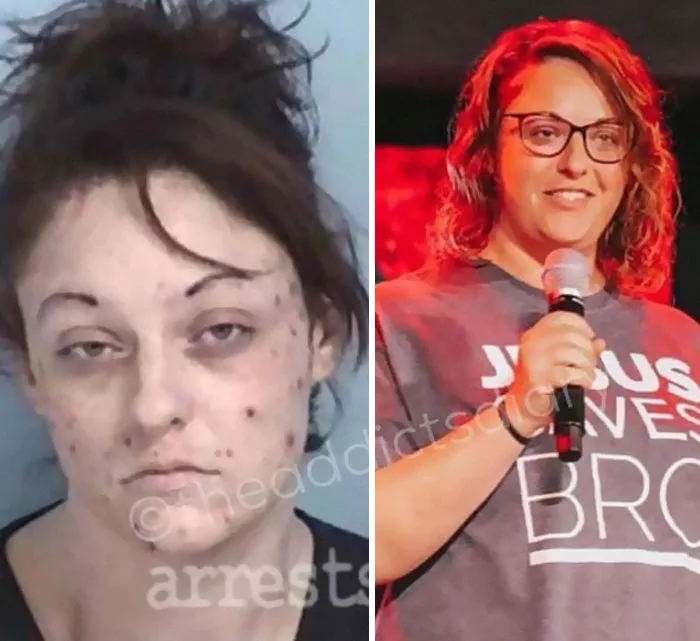 “Diario de un adicto”: 20 impactantes transformaciones de gente que solía ser adicta a las drogas (Nuevas historias)