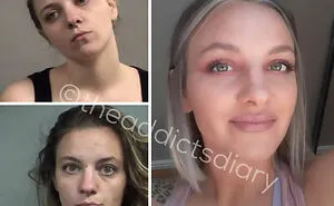 ‘The Addict’s Diary’: 30 Powerful Before & After Transformations Of Drug Addicts (New Stories)