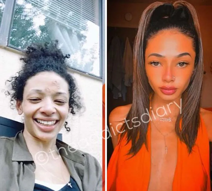 ‘The Addict’s Diary’: 30 Powerful Before & After Transformations Of Drug Addicts (New Stories)